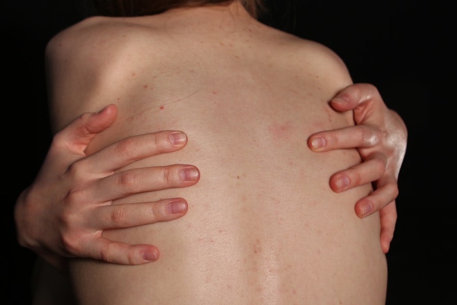 Photo Surgical scars