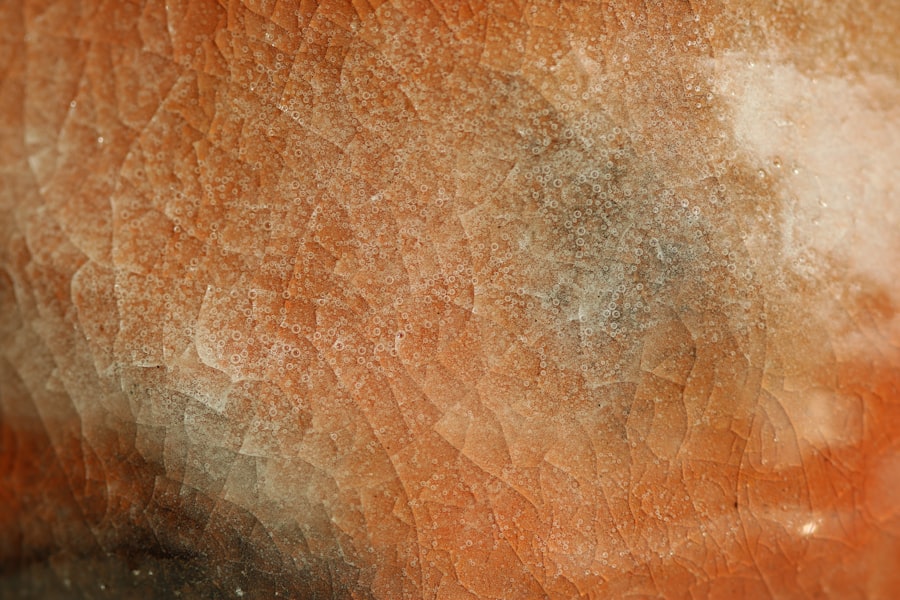Photo Skin biopsy