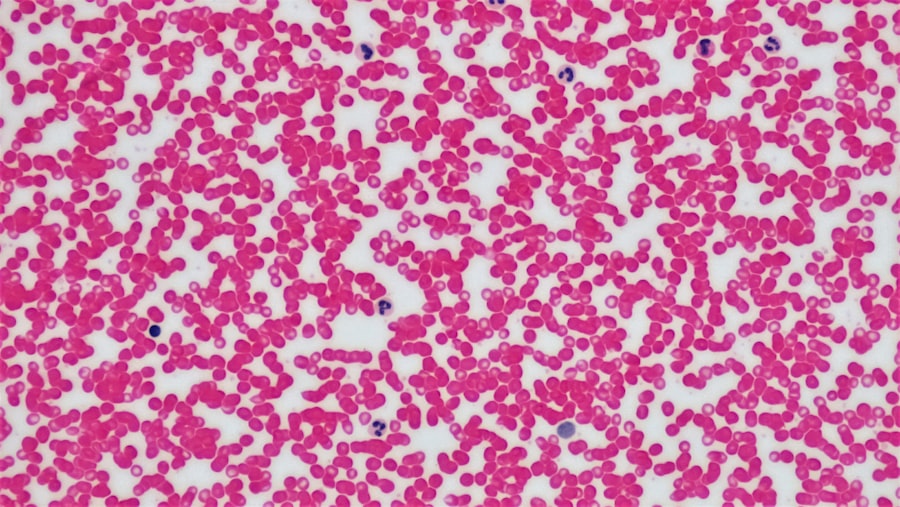 Photo Blood smear