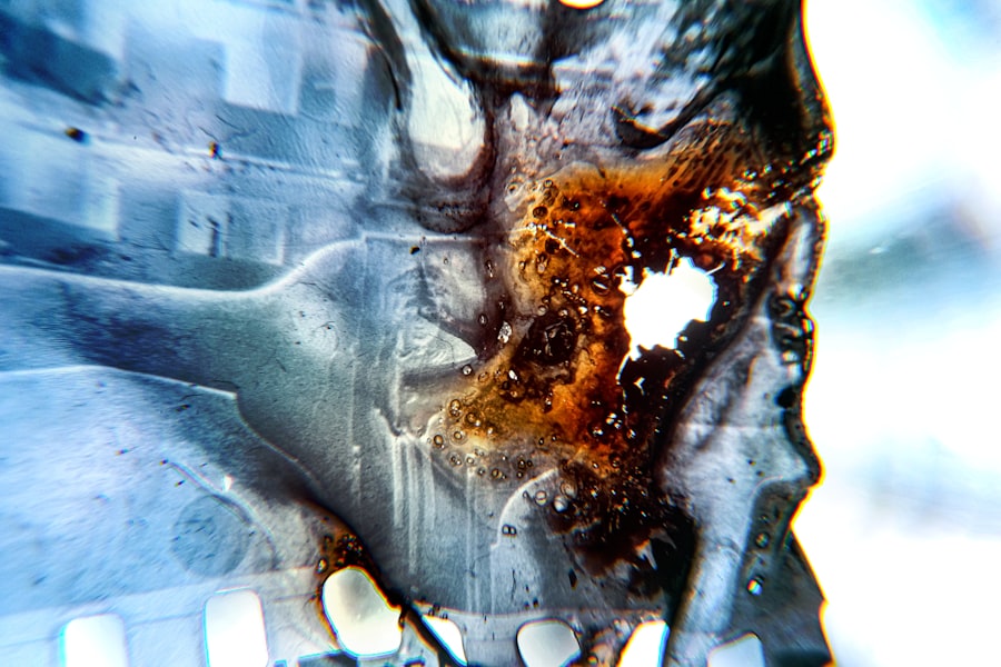 Photo X-ray scan