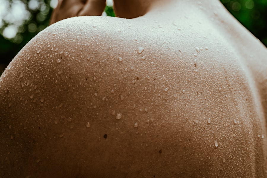 Photo Skin rash