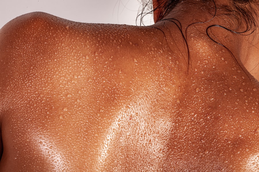 Photo Skin lesions