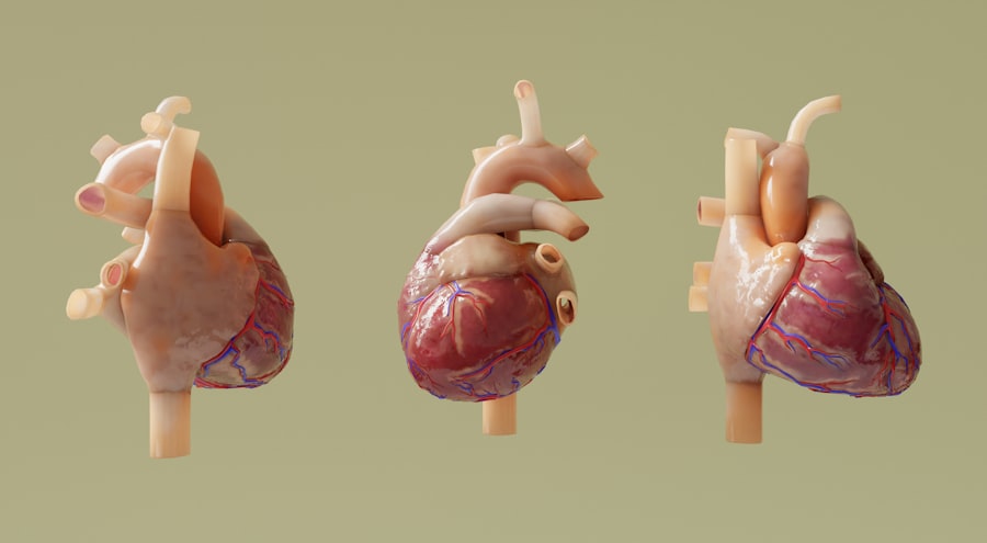 Photo Heart diagram