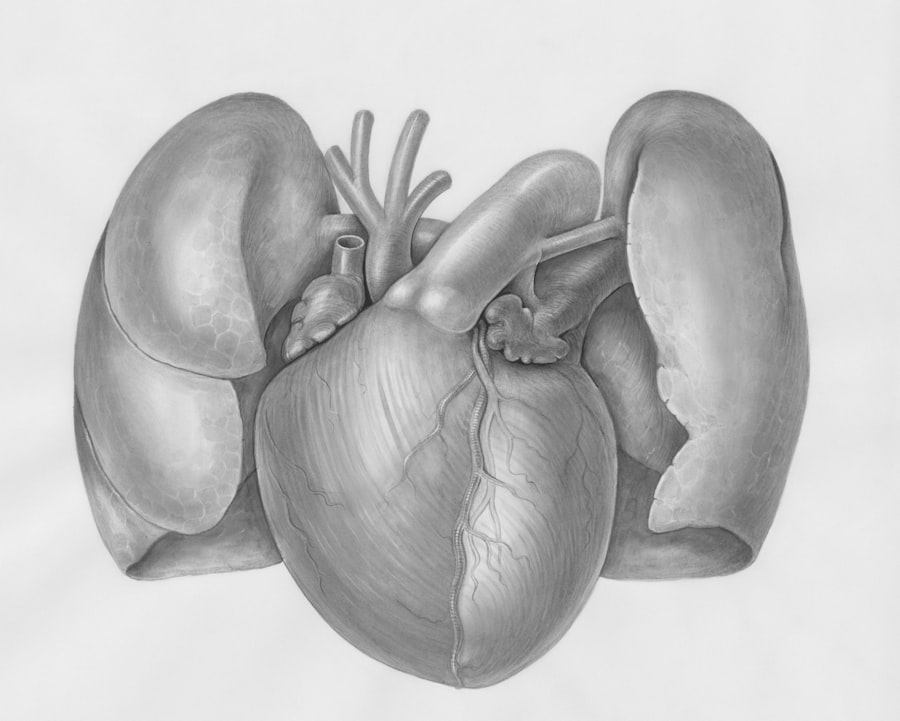 Photo Blocked artery