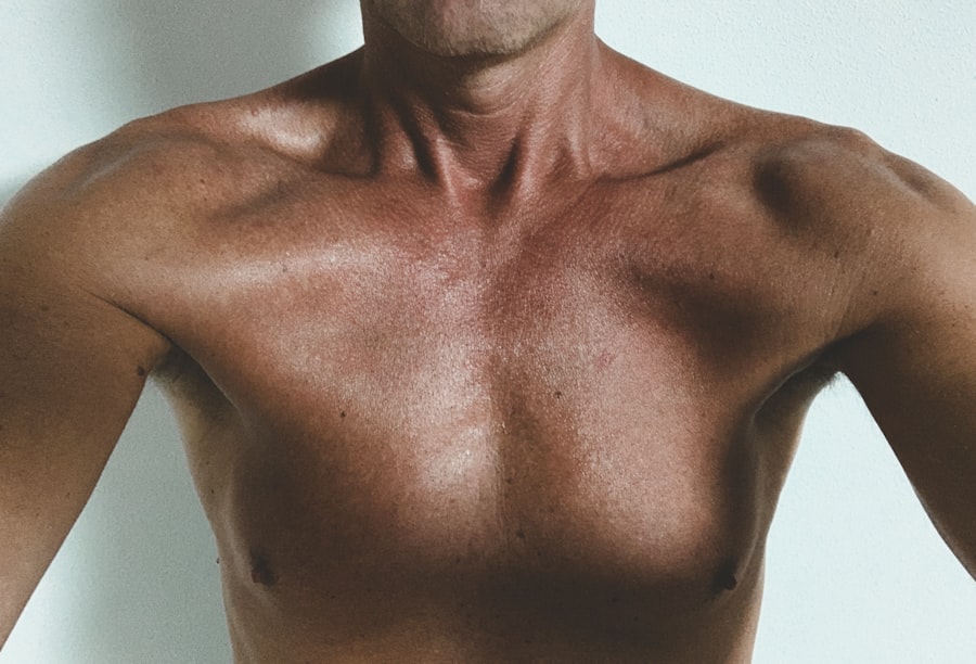 Photo Chest pain
