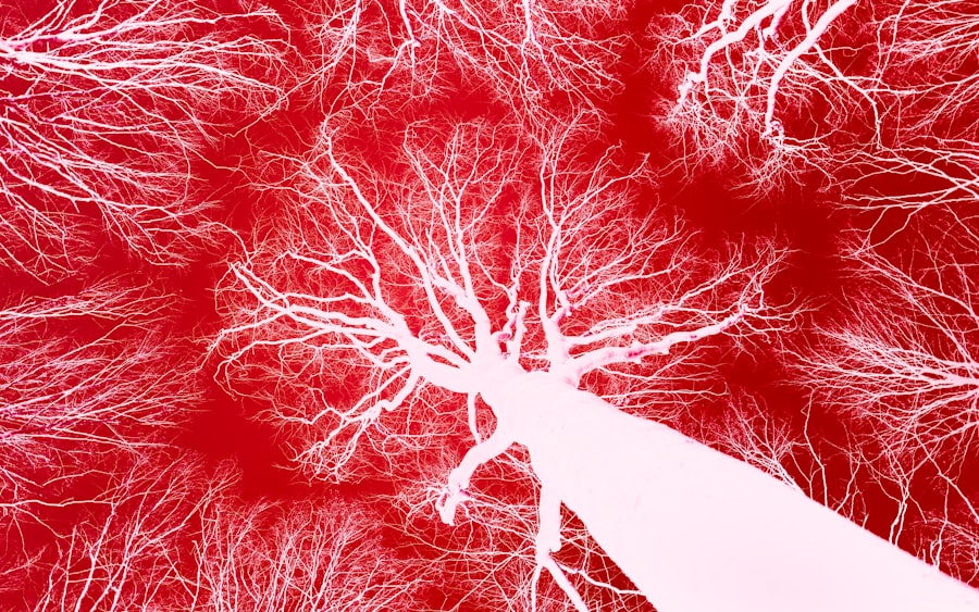 Photo Blocked artery