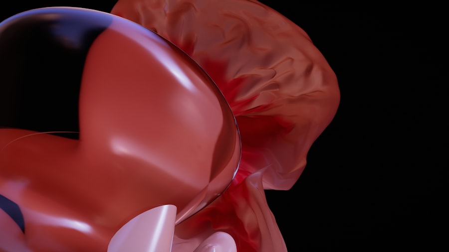 Photo Blocked artery