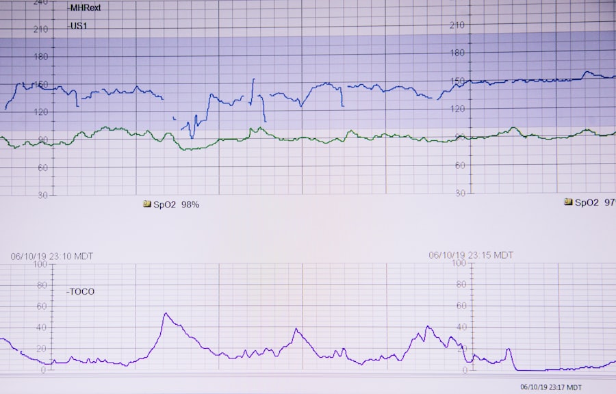 Photo heart monitor