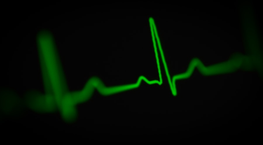 Photo Heart monitor