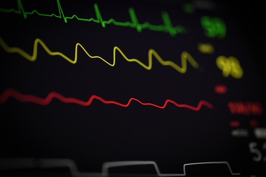 Photo Heart monitor