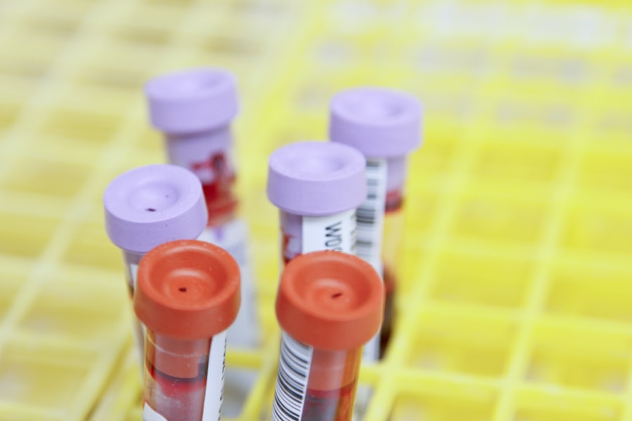 Photo Blood sample