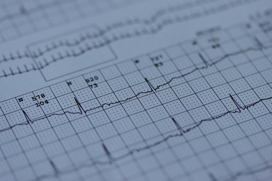 Photo Heart monitor