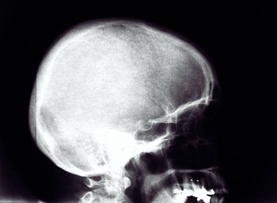 Photo Brain scan