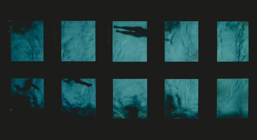 Photo MRI scan